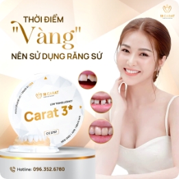 Ra Mắt Thương Hiệu Răng Sứ 18 CARAT  – Kiến Tạo Vẻ Đẹp Độc Bản Vượt Thời Gian