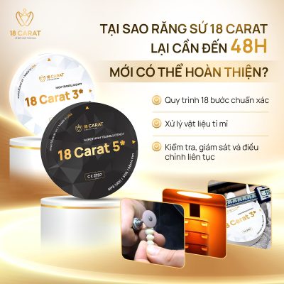 Chất lượng ưu việt của răng sứ 18 Carat