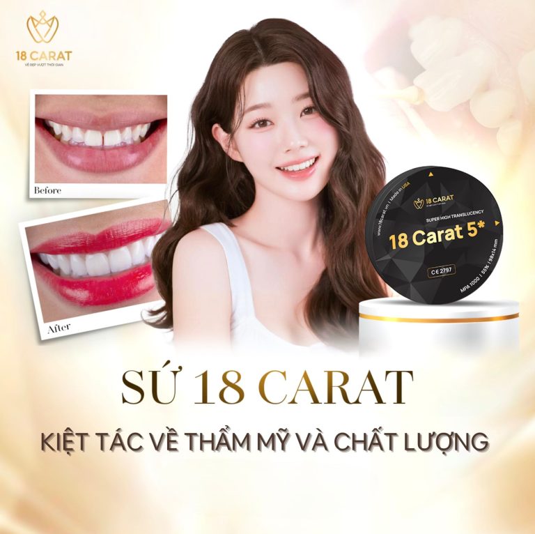 18 Carat nổi bật về thẩm mỹ và chất lượng vượt trội